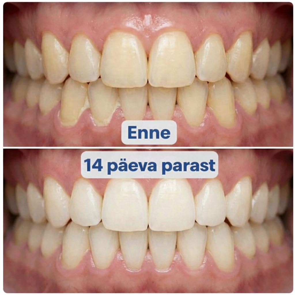 3-ühes kahesuunaline 360° pöörlev hambahari (valge)