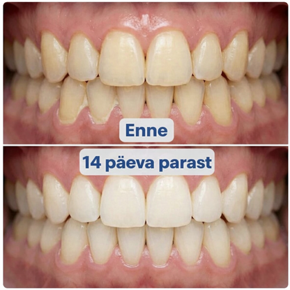 3-ühes kahesuunaline 360° pöörlev hambahari (valge)